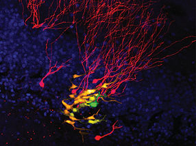 Stem cell divisions in the adult brain seen for the first time