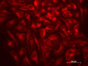 A new way to stimulate cellular recycling process