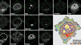 New Method Refines Cell Sample Analysis
