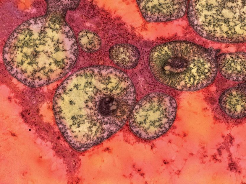 Elevated hormone flags liver problems in mice with methylmalonic acidemia - Study findings can immediately be applied to human patients with the disease