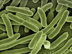 Cracking colibactin's code