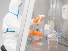 OPTIMA pharma started a cooperation with Charité and the Berlin Institute of Health