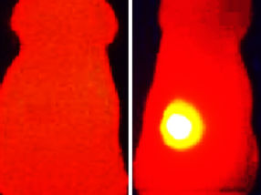 Black nanoparticles slow the growth of tumors