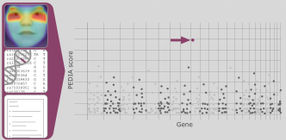 How Artificial Intelligence Detects Rare Diseases