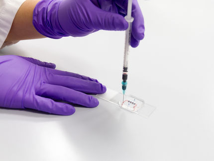 Retina-on-a-chip provides powerful tool for studying eye disease