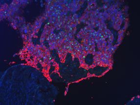 Tumour growth roadmap developed