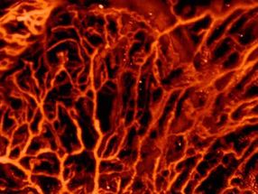 Artificial intelligence improves biomedical imaging