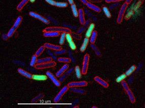 Antibiotics with Novel Mechanism of Action Discovered
