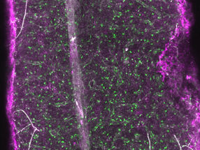 Innovative method delivers new insights into the stem cell microenvironment – Bone marrow in 3D