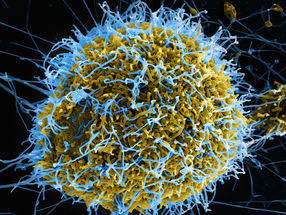 Recognise and control new variants of the deadly Ebola virus more quickly