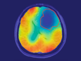 Using oxygen to make cancer visible
