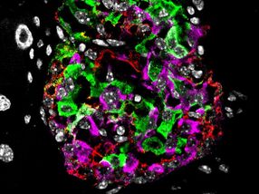 New drug combination restores beta cell function in animal model