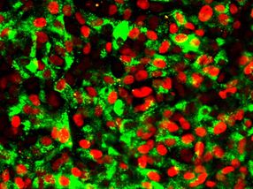 Beta cells from stem cells: Potential for cell replacement therapy