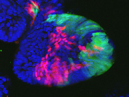 Using mini colons to detect functional differences and weaknesses of colorectal cancer