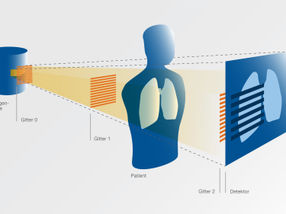 New x-ray method for Corona diagnosis ready for patient testing