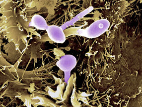 Antibiotics affect balance of intestinal microbiome