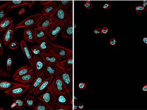Photopharmacology - A light-trigger for the proteasome