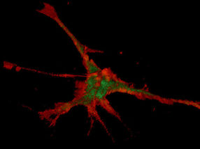 Initial steps to show nerves their growth direction magnetically