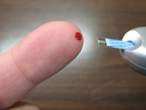 Scientists Discover a Promising New Target for Diabetes Treatment