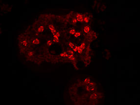 Defense alliance: Microscopic enemies targeted