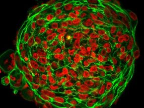Cancer Cells Become Fluidised and Squeeze Through Tissue