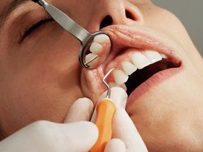 The First Comprehensive Single-Cell Atlas of Human Teeth