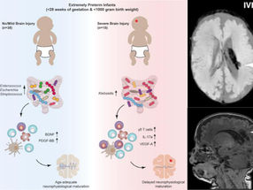 Gut bacteria influence brain development