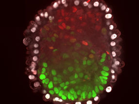 Stem cells organize themselves into embryoid
