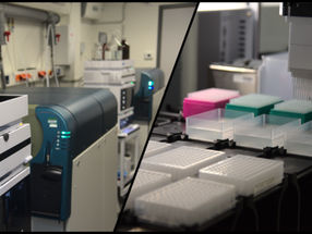 Machine learning model uses blood tests to predict COVID-19 survival
