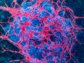 Harvard University licenses kidney engineering technology to newly launched startup