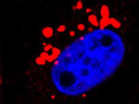 Strategy designed to identify therapeutic targets in triple-negative breast cancer