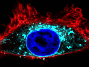 Palmitoylation, a new target for anti-cancer drugs