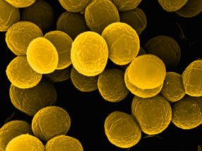 A bright spot for microbiological diagnostics