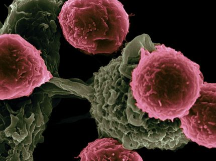 Evotec adds cell therapy manufacturing facility with acquisition of Rigenerand