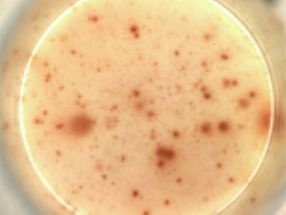 Are we on our way to a one-time treatment for AIDS?