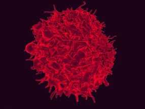Stained scanning electron micrograph of a T lymphocyte.