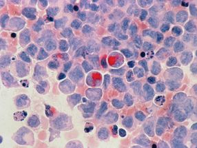 Improving the effectiveness of existing chemotherapy