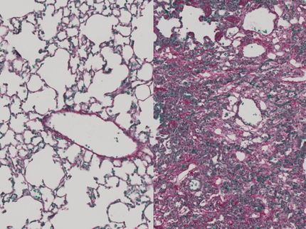 Immunotherapy Reduces Lung and Liver Fibrosis in Mice