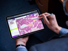 Aignostics Raises €14m Series A to Advance AI-powered Pathology