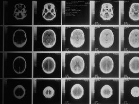 Show me your brain scan and I'll tell you how old you really are
