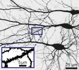Switching brain cells with less light