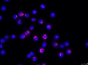 More detailed analysis of how cells react to stress