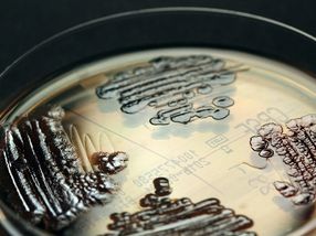 How are dreaded multidrug-resistant pathogens brought into hospitals?