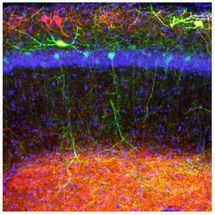 Cellular Mechanism Provides Explanation Model for Declining Memory Performance in Alzheimer's Disease