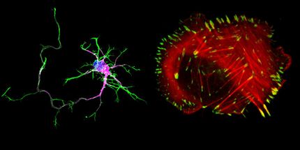 An unexpected link between cancer and autism discovered