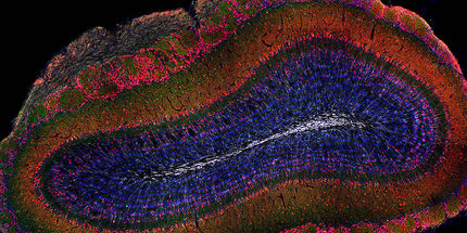 Distant Brain Regions Selectively Recruit Stem Cells