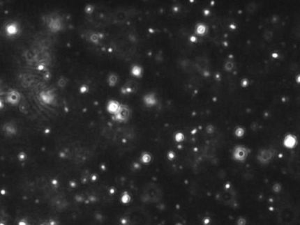 Exosomes as way to make 'personalized medicine' easier and more precise