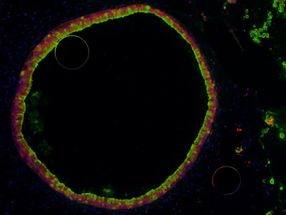 Bacteria may help babies' digestive tracts more than suspected, scientists find