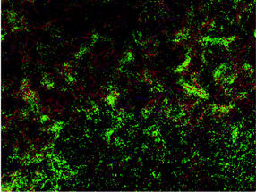 Hemophilia: Training the immune system to be tolerant