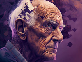 AI detects rare forms of dementia